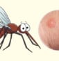 Muỗi cắn làm độc – Muỗi độc và cách xử lý khi bị muỗi độc cắn